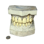 Vintage Large Dental Teaching Model Teeth Jaw Dentist Orthodontic Demonstration