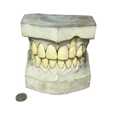 Vintage Large Dental Teaching Model Teeth Jaw Dentist Orthodontic Demonstration