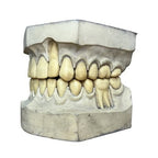 Vintage Large Dental Teaching Model Teeth Jaw Dentist Orthodontic Demonstration