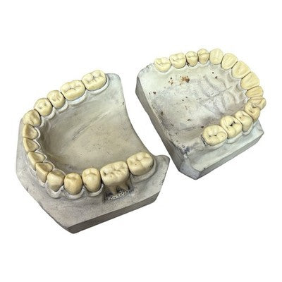 Vintage Large Dental Teaching Model Teeth Jaw Dentist Orthodontic Demonstration