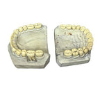 Vintage Large Dental Teaching Model Teeth Jaw Dentist Orthodontic Demonstration