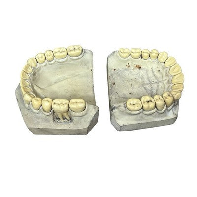 Vintage Large Dental Teaching Model Teeth Jaw Dentist Orthodontic Demonstration