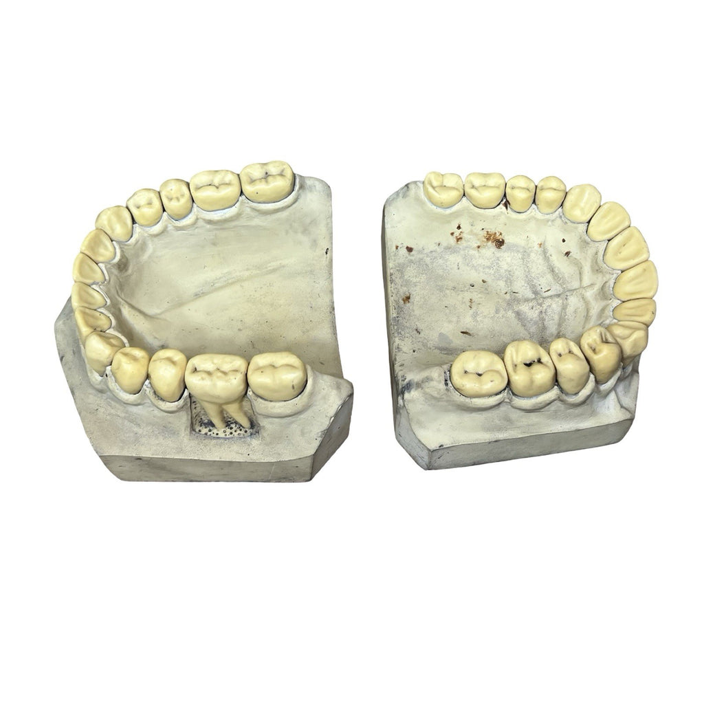 Vintage Large Dental Teaching Model Teeth Jaw Dentist Orthodontic Demonstration